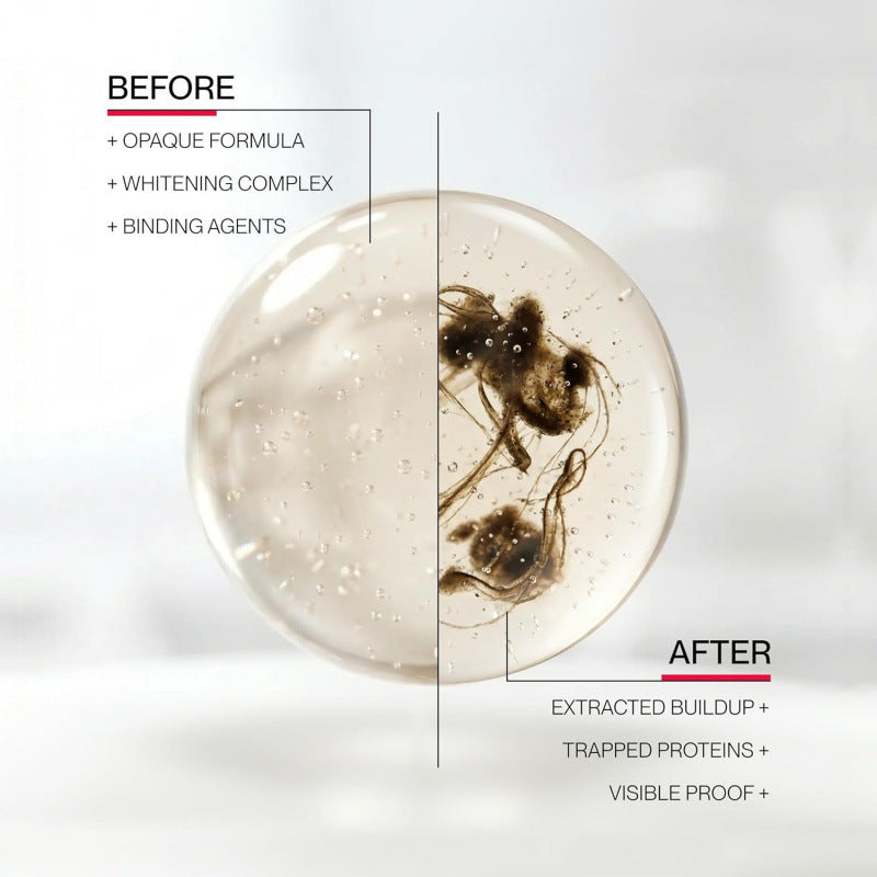 Teeth Whitening Mouthwash – Stain Removal